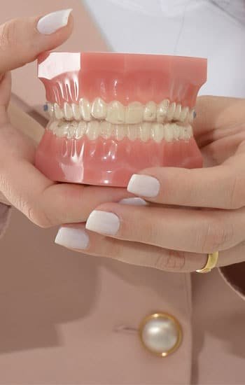 Aparelhos Invisalign - Modernidade e conforto para o seu sorriso!
